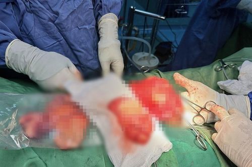 Người đàn ông mang khối u tinh hoàn nặng gần 1 kg