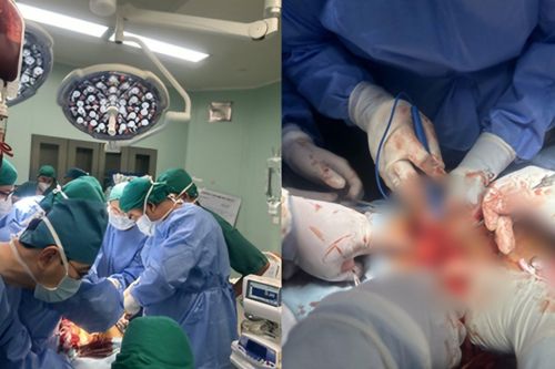 3 bệnh viện tại TPHCM kích hoạt 'báo động đỏ' đối với bệnh nhân bị đâm lủng phổi