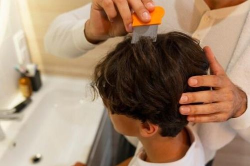 Bé trai bị lây bệnh nấm tổ ong da đầu