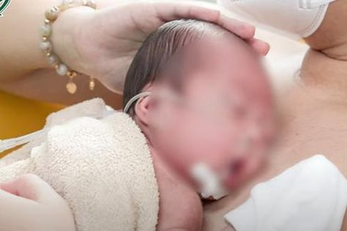 Hy hữu: Bé gái chào đời nặng hơn 3,6kg với hội chứng siêu nữ