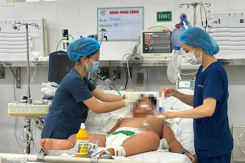 Bệnh nhi bị ngộ độc thực phẩm nặng ở Long Khánh đã cai được máy thở
