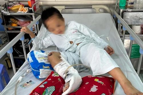 MS 925: Bé trai dân tộc Mông bị tai nạn 'nát' một bên chân cần gấp sự cứu giúp của cộng đồng