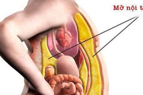Mỡ nội tạng có hại thế nào với sức khỏe?