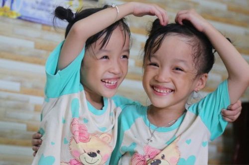 4 năm sau cuộc đại phẫu thuật tách rời, cặp song sinh dính liền Trúc Nhi - Diệu Nhi hiện ra sao?