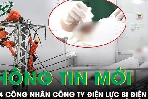 Điều tra nguyên nhân vụ tai nạn giật điện khiến 4 công nhân bị bỏng nghiêm trọng