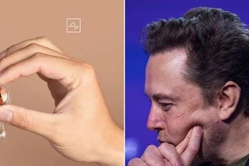 Con chip lần đầu tiên được cấy vào não người của Elon Musk nảy sinh vấn đề