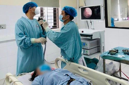 Kẹt xương trong phổi từ một lần ho sặc thức ăn 25 năm trước