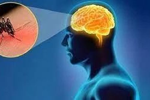 Đắk Lắk ghi nhận một trường hợp mắc bệnh viêm não Nhật Bản