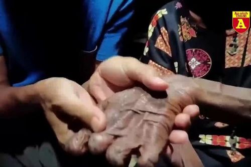 'Hãi hùng' hủ tục cắt ngón tay của bộ tộc Dani ở Indonesia