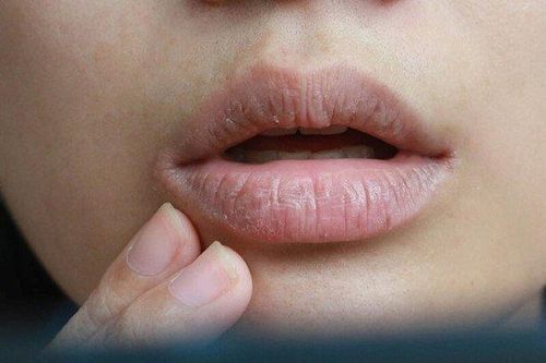 Tin tức Đời sống 13/5: Khô miệng có thể là 'báo động đỏ' 5 căn bệnh nguy hiểm
