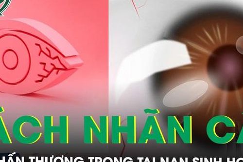 Người đàn ông rách nhãn cầu khi sửa chuồng gà