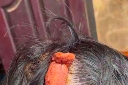 Đắk Lắk: Bắt giam 2 đối tượng để điều tra hành vi cố ý gây thương tích