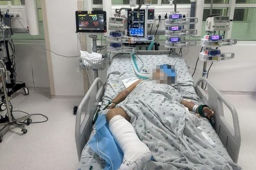 Bé trai 9 tuổi nhập viện với chân trái dập nát