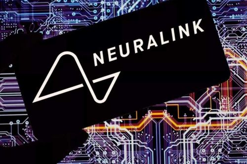Chip đọc não của Elon Musk bị 'lỏng dây'