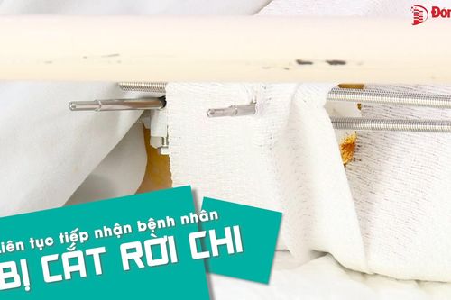 Liên tục tiếp nhận bệnh nhân bị cắt rời chi