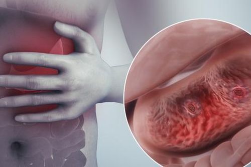 8 dấu hiệu cho thấy dạ dày của bạn đang có một vết loét nghiêm trọng