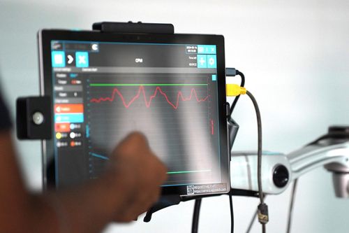 Nâng cao khả năng hồi phục cho người đột quỵ bằng trí tuệ nhân tạo AI
