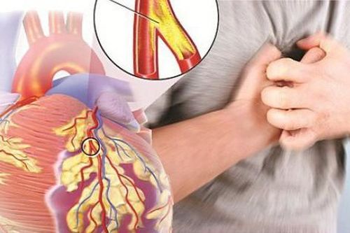 3 lưu ý tự chăm sóc bản thân khi mắc suy tim