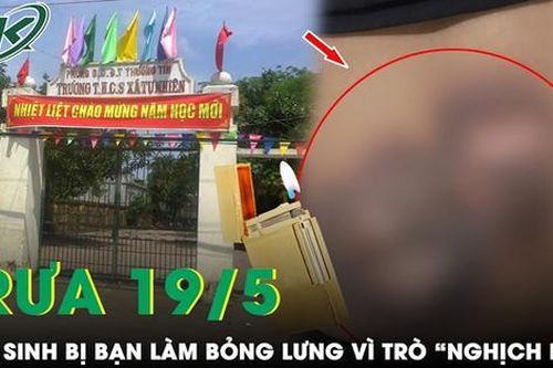 Trưa 19/5: Xót xa nam sinh lớp 9 bị bạn làm bỏng do chơi trò giác hơi bằng khí ga bật lửa