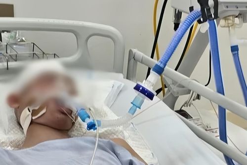 Diễn biến mới vụ nam sinh lớp 8 ở Hà Nội bị đánh chấn thương sọ não