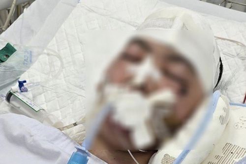 Chuyển nam sinh lớp 8 bị đánh chấn thương sọ não tới Bệnh viện Nhi Trung ương