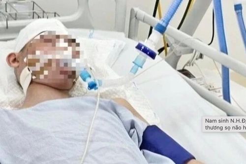 Vụ nam sinh lớp 8 bị đánh chấn thương não: Không có 'phép màu' nào xảy ra