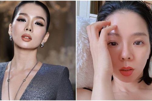Lệ Quyên thẳng thắn nêu quan điểm khi được khuyên cấy mỡ vào mặt để trẻ hơn vài tuổi?