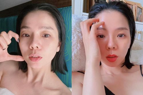 Lệ Quyên từ chối lời khuyên cấy mỡ để trẻ trung
