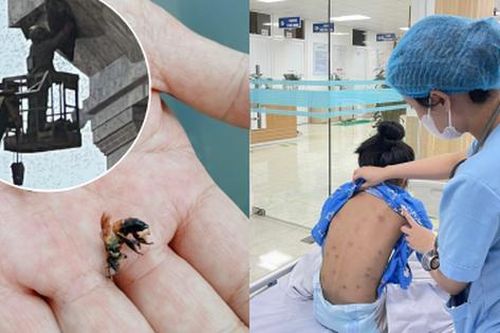 Sức khỏe của 2 em bé trong vụ bị ong đốt ở Hải Phòng giờ ra sao?