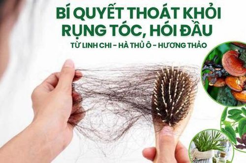 Bí quyết thoát khỏi rụng tóc, hói đầu với bộ 3 dược liệu quen thuộc