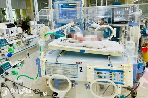 2 bệnh viện hợp sức cứu mẹ con sản phụ bị suy hô hấp nặng