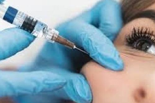 Đỏ rát mặt sau tiêm filler tạo hình mũi ở spa
