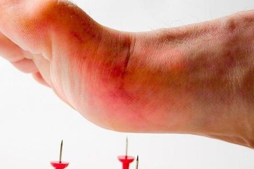Người sau mắc bệnh uốn ván nên tập thể dục thế nào?
