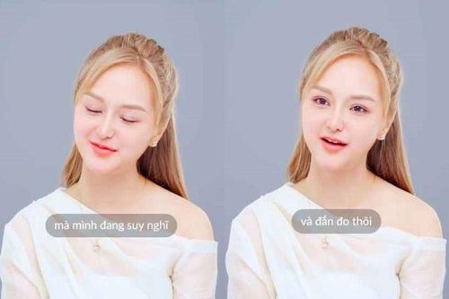 Gấm Kami hé lộ về lộ trình tiếp tục phẫu thuật thẩm mỹ