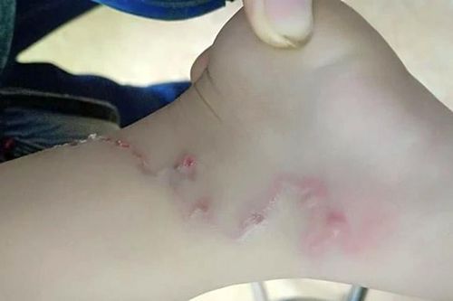 Cảnh giác với nguy cơ mắc bệnh lây truyền từ thú cưng