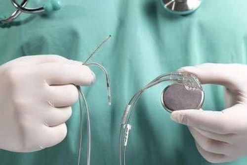 Đặt máy tạo nhịp tim cứu sống bệnh nhân cao tuổi mắc nhiều bệnh nền