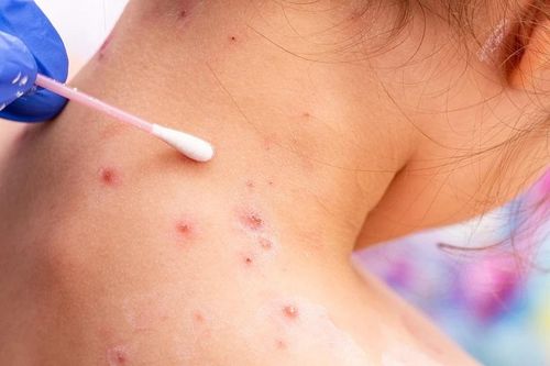 Bé trai nguy kịch vì căn bệnh quen thuộc