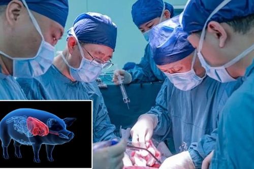 Các nhà khoa học Trung Quốc ghép thành công gan lợn chỉnh sửa gene cho người sống