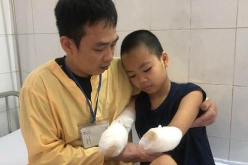 MS 929: Xót xa trước ước mong của bé gái 12 tuổi mất đi đôi tay vì bỏng điện