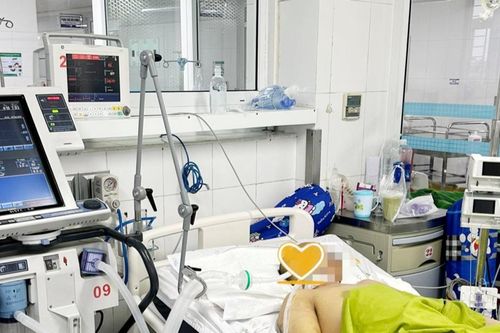 Cảnh báo nguy cơ sốc nhiệt sau 2 tiếng chạy xe máy giữa trưa