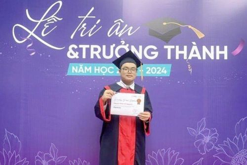 Diện mạo Bi béo gây chú ý trong lễ trưởng thành