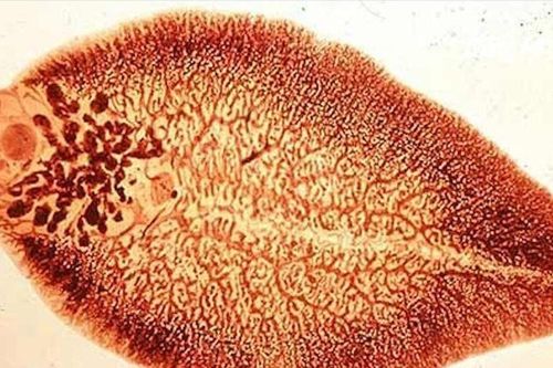 Mắc sán lá gan vì nghiện ăn rau sống