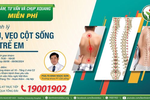 Bệnh viện Hữu nghị Việt Đức khám sàng lọc miễn phí và phẫu thuật điều trị gù vẹo cột sống ở trẻ em