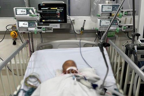 Bé 10 tháng tuổi bị amip ăn não