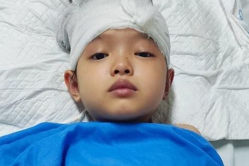MS 930: Bé gái bị khối u não mong được sự giúp đỡ để được phẫu thuật