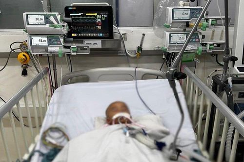 Bé 10 tháng tuổi bị bệnh A-mip 'ăn não'