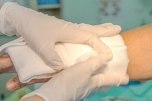 Điều trị vết bỏng bằng băng làm từ thực vật thân thiện với môi trường