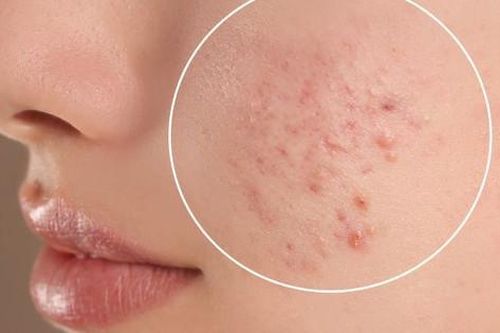 6 biểu hiện ở da cho thấy bạn đang thiếu vitamin