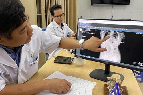 Chuyên gia chỉ dấu hiệu phát hiện sớm, phương án điều trị cong vẹo cột sống ở trẻ