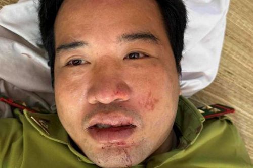 Xe chở lâm sản trái phép đâm trọng thương Trạm trưởng trạm kiểm lâm